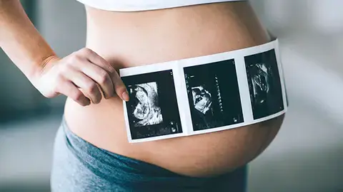 懷孕超音波檢查 Q&A